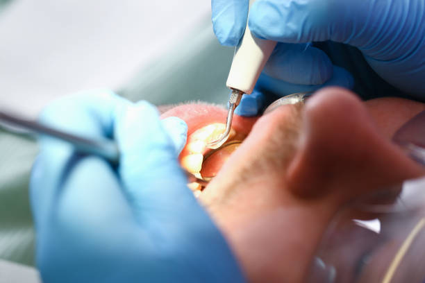 Best Emergency Dental Care for Broken or Chipped Teeth in Manorville, NY