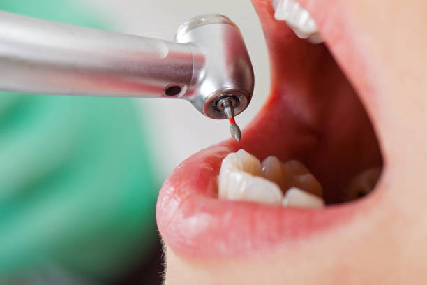 Best Emergency Denture Repair in Manorville, NY